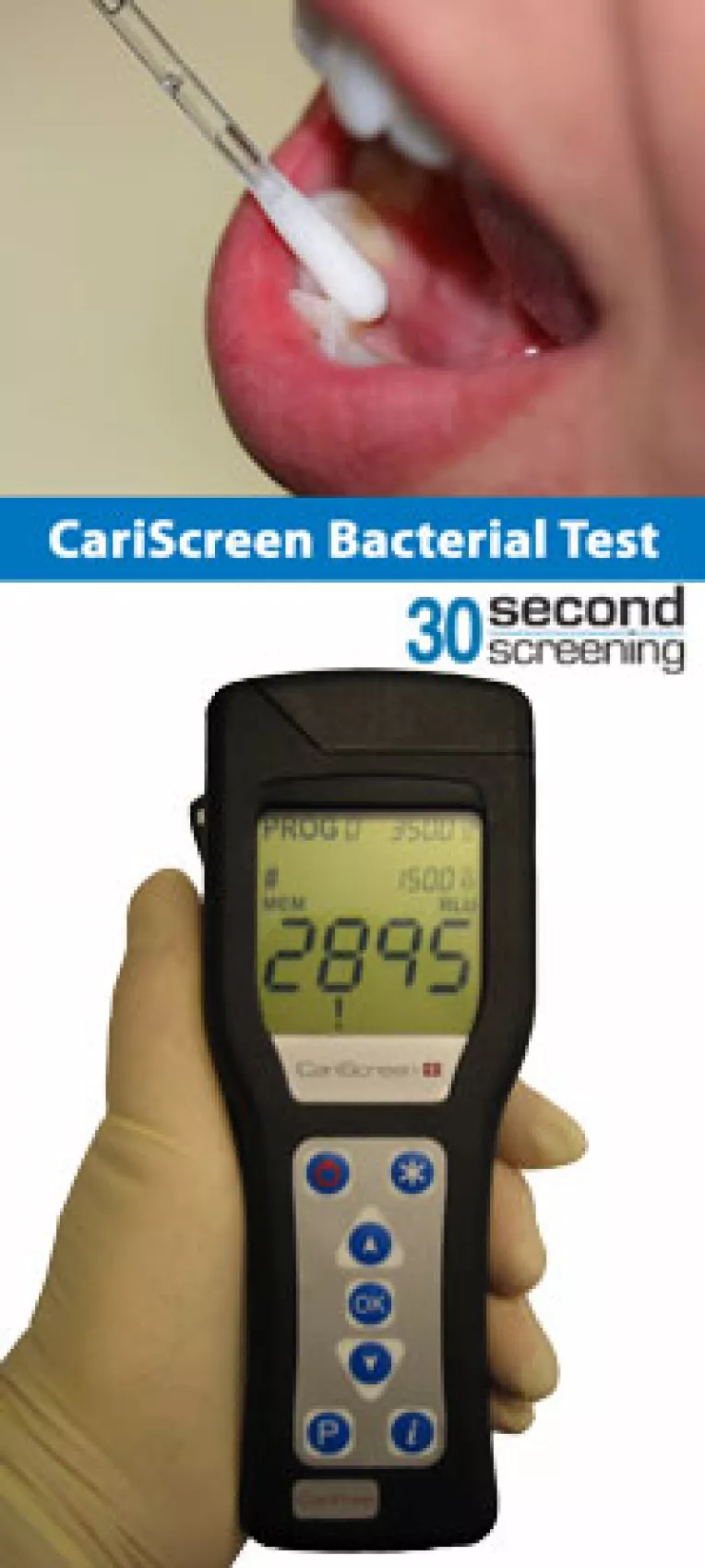 CAMBRA (Caries Management by Risk Asseement) 
Managementul  Cariilor si Evaluarea Riscului Carios
