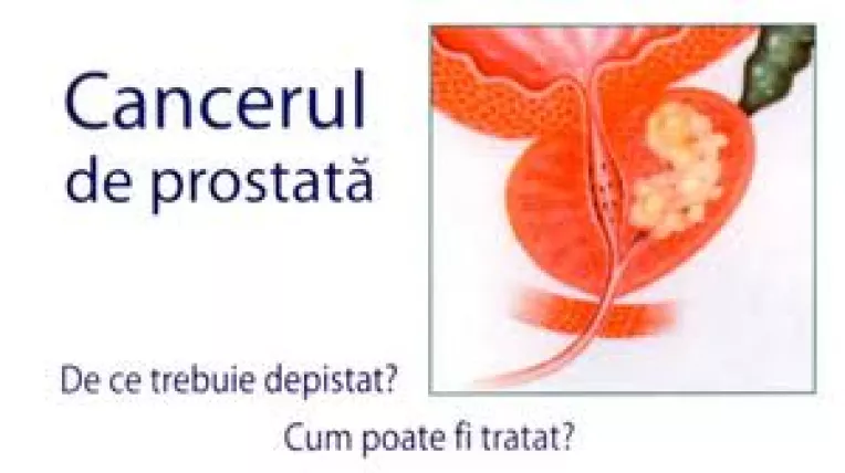 Cancerul de prostata este cel mai frecvent cancer al aparatului uro-genital masculin
