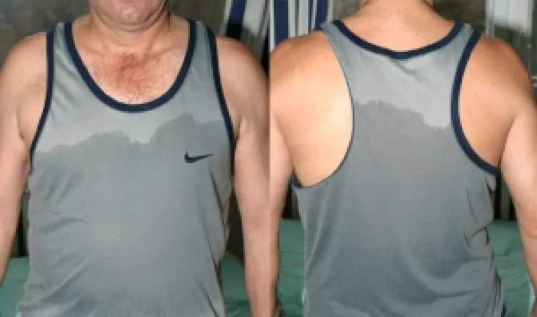 Hiperhidroza sau transpiratia excesiva, o boala care afecteaza milioane de oameni!