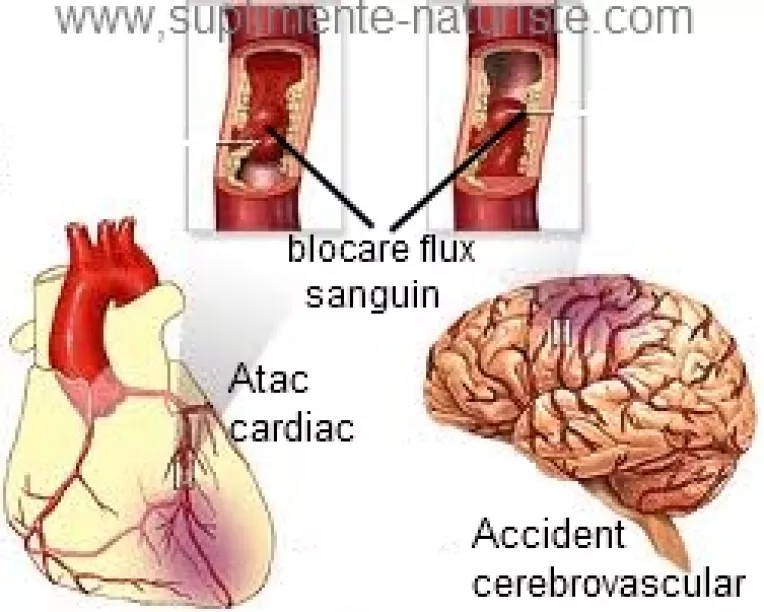 Studiu: Medicamentele pentru controlarea presiunii arteriale, de fapt, MARESC riscul de a suferi un atac de cord sau infarct
