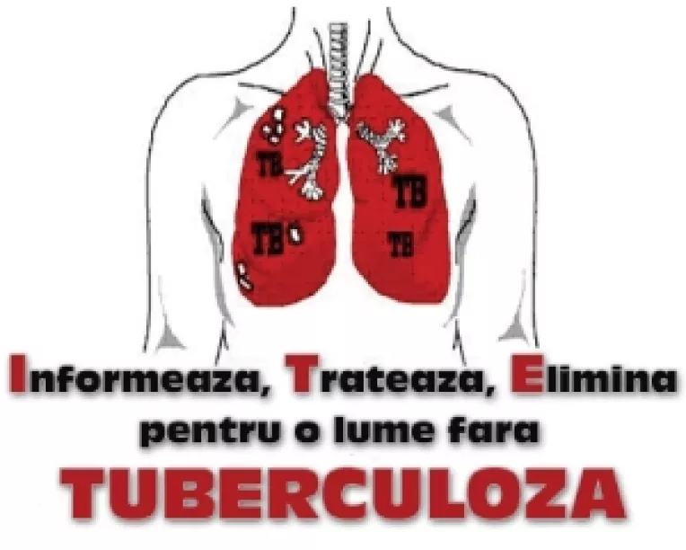 Tuberculoza : Romania este printre primele tari in  Europa la numarul de cazuri noi si recidive